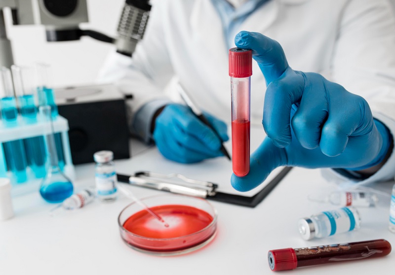 Low Anti-Mullerian Hormone (AMH): Symptoms, Causes, Treatment