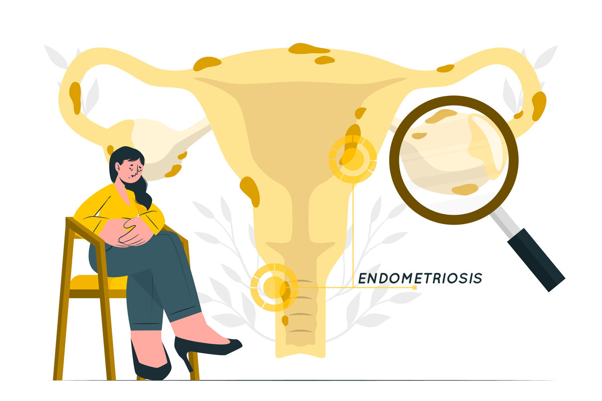 Endometriosis Pain Management: Causes, Treatment, Pain Relief Strategies