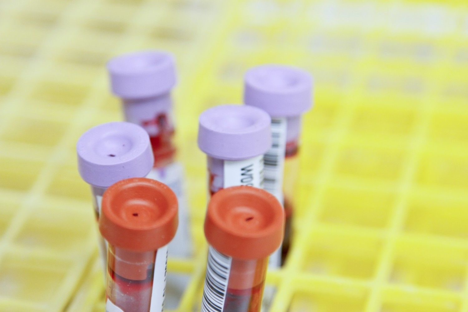 Understanding Beta HCG Levels After IVF